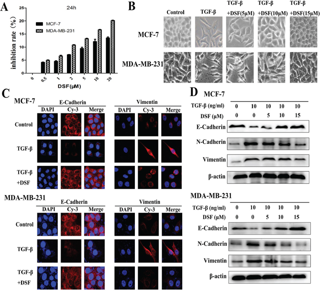 DSF inhibits TGF-&#x03B2;-induced EMT in breast cancer cells.