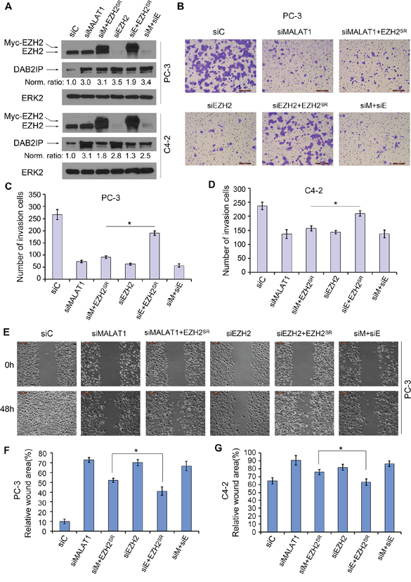 MALAT1 facilitates EZH2-mediated PCa cell migration and invasion.
