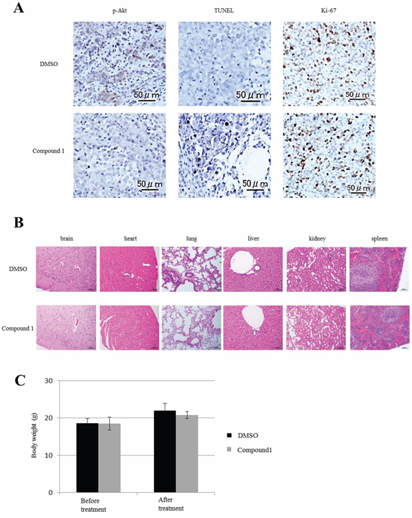 Effect of compound 1 on orthotopic tumors and major organs in vivo.