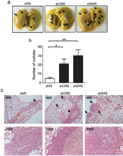 CMTM7 knockdown enhances lung metastasis of A549 cells.