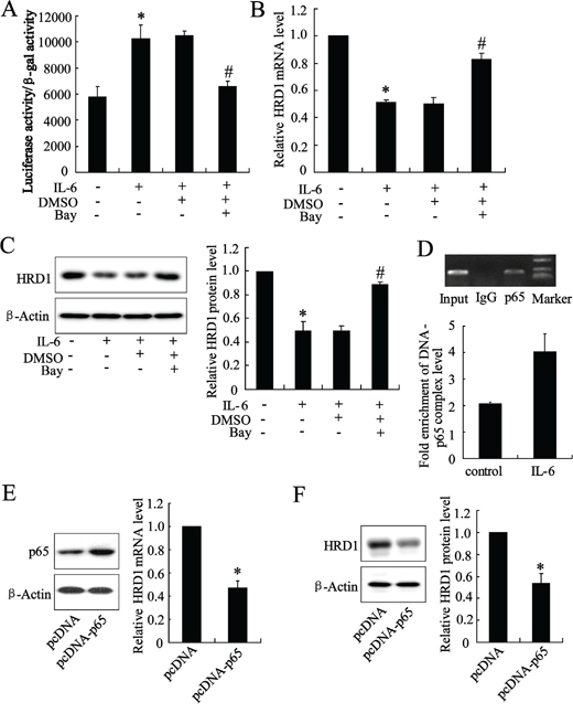 The expression of HRD1 was downregulated by NF-&#x03BA;B activation.