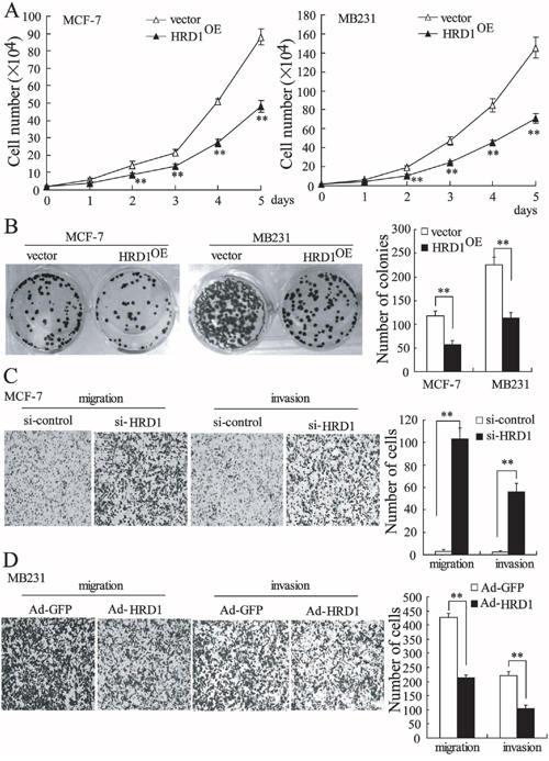 HRD1 inhibits growth, colony formation, migration, and invasion of breast cancer cells.