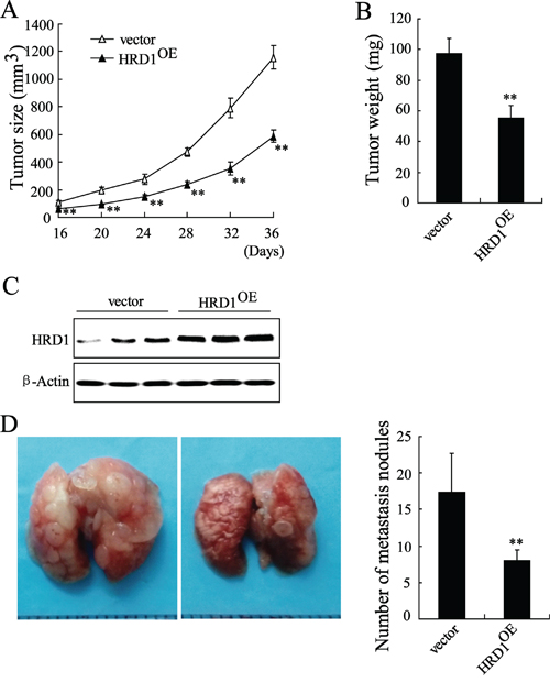 Overexpression of HRD1 in breast cancer cells inhibits in vivo tumor growth and metastasis.