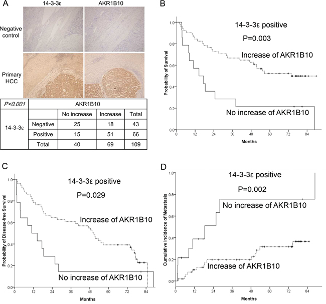 Prognostic analysis of 14-3-3&#x03B5; and AKR1B10 in HCC tumors.