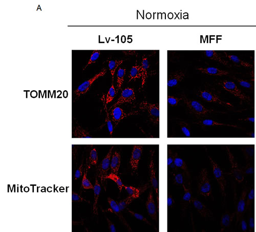 Fibroblasts over-expressing MFF show mitochondrial dysfunction.