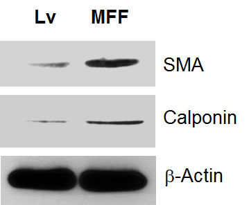 Fibroblasts over-expressing MFF show myofibroblastic features.