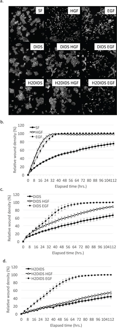 DIDS and H2DIDS reduce HGF-induced but not EGF-induced cell scattering and wound healing.