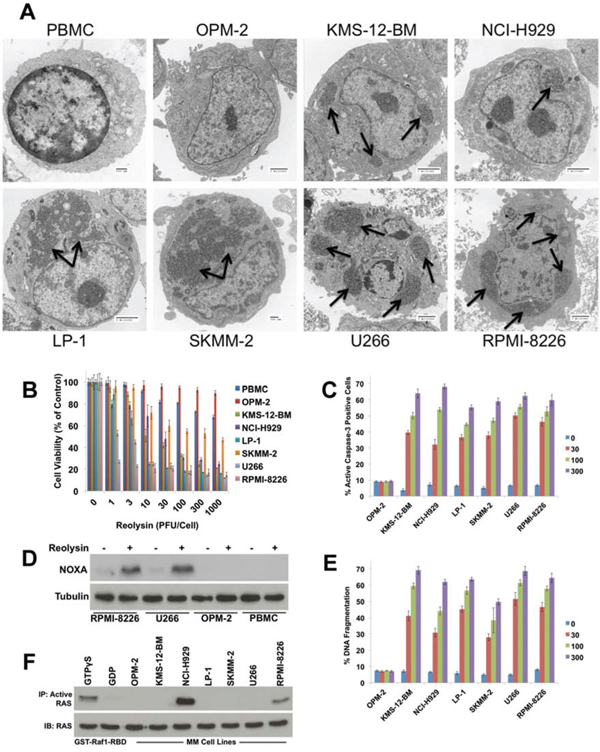 Reovirus replication in MM cells induces apoptosis independently of RAS activity status.