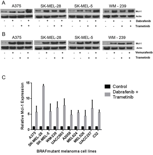 Dabrafenib-Trametinib combination induces Mcl-1 expression in melanoma cells causing drug resistance.