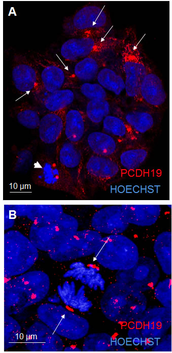 PCDH19 localization in iPSC colony.