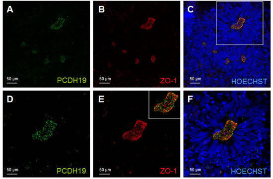 PCDH19 localization in the lumen of the neural rosette.