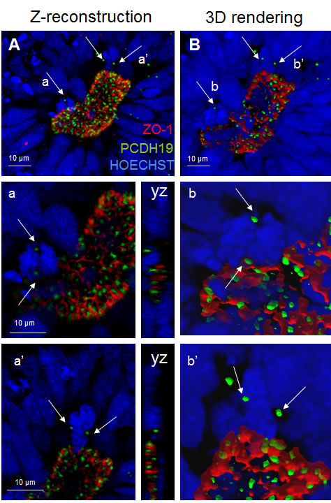 PCDH19 localization in the lumen of the neural rosettes.