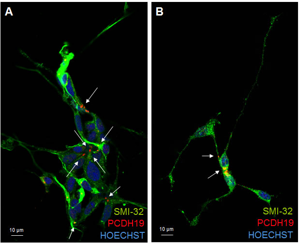 PCDH19 localization in mature neurons.