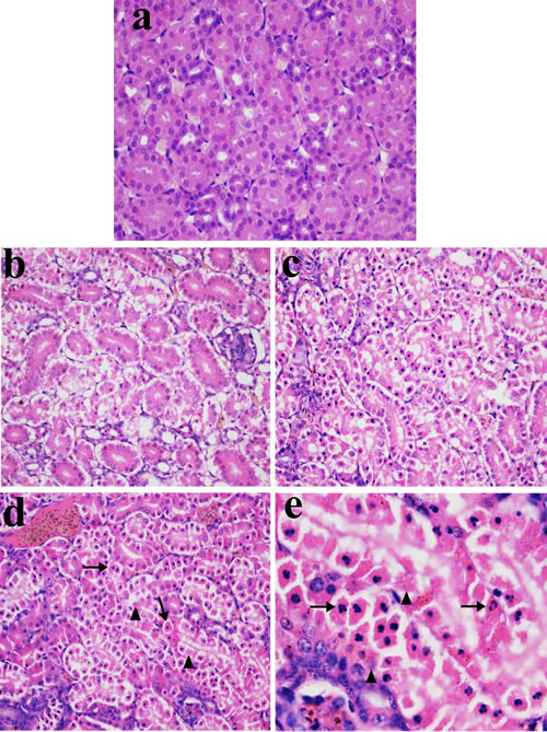 Histopathological changes in kidney at 28 days of age.