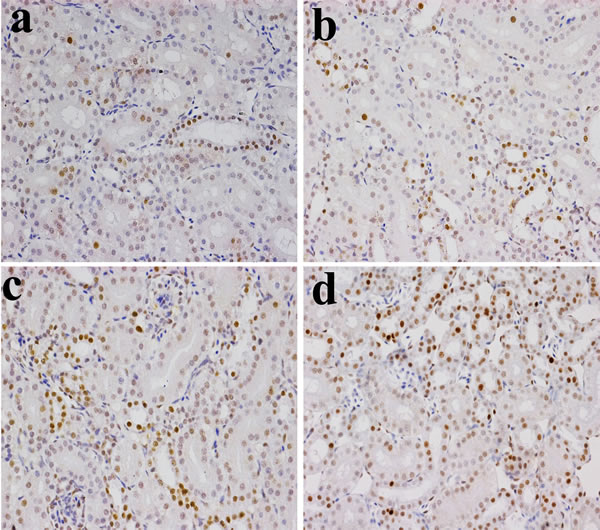 Changes of NF-&#x3ba;B protein expression levels in the kidney (&times;400) by immunohistochemistry at 28 days of age.