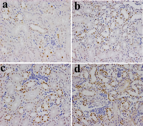 Changes of NF-&#x3ba;B protein expression levels in the kidney (&times;400) by immunohistochemistry at 42 days of age.