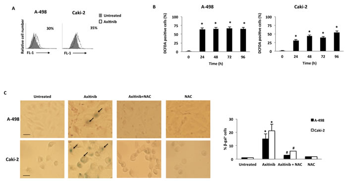 Axitinib induces cellular senescence in RCC cells in a ROS-dependent manner.