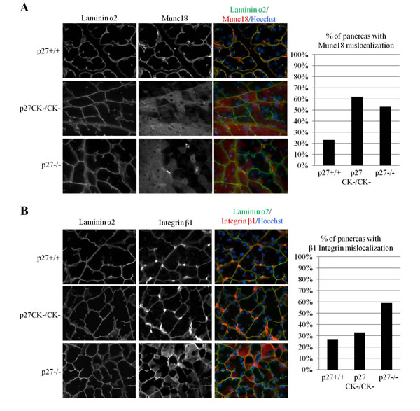 Mislocalization of integrin&#x3b2;1 and Munc18 in acinar cells of p27