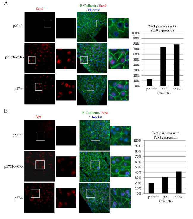 Expression of Sox9 and Pdx1 in acinar cells of p27