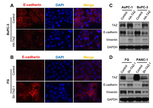 Influence of TAZ expression on the EMT phenotype of pancreatic cancer cells.
