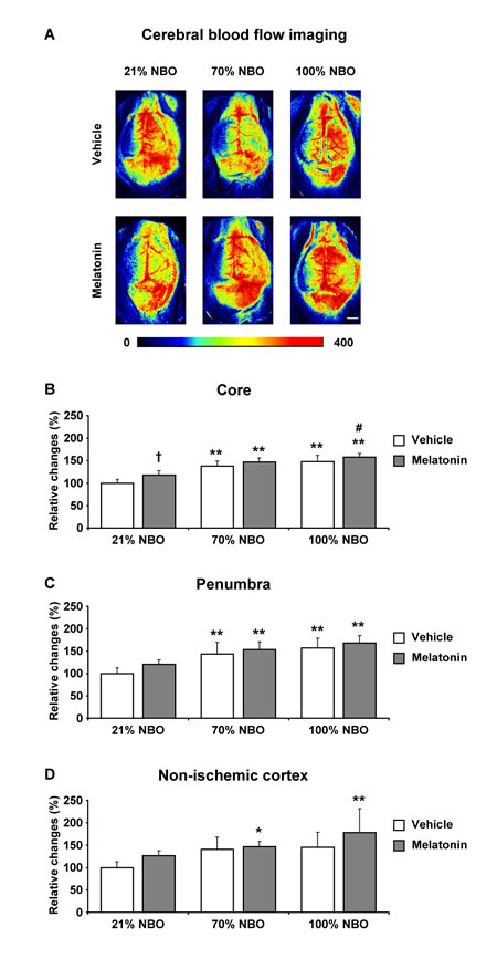 Effects of normobaric oxygen and melatonin on post-ischemic regional cerebral blood flow.