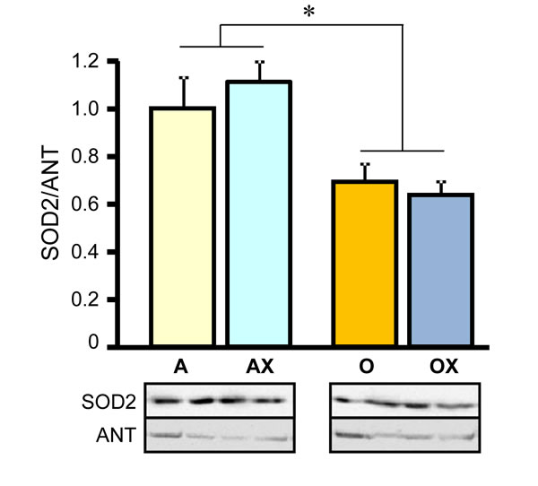 Protein levels of superoxide dismutase 2 (SOD2) in gastrocnemius mitochondria isolated from adult (A, AX) and old (O, OX) rats treated or untreated with XJB.