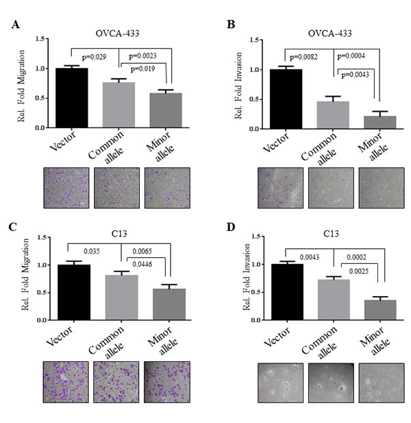 Inhibitory effects of rs17427875 (A &gt; T) on EOC migration and invasion.