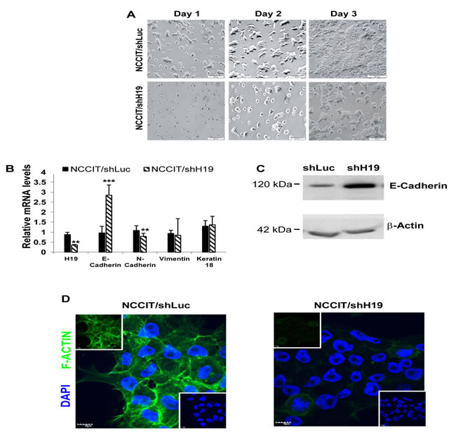 H19 knockdown decreases hEC cell-matrix attachment and decreases hEC cell-cell interactions.