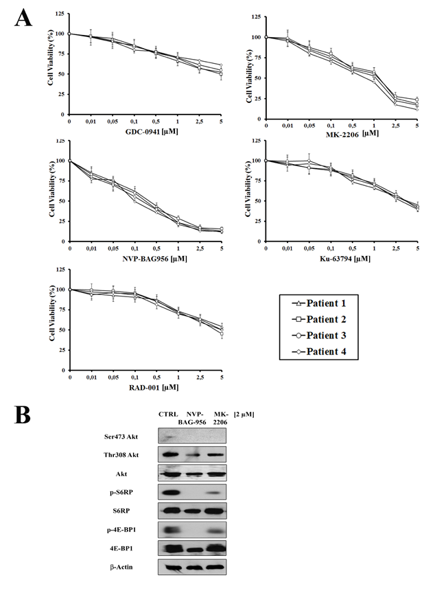 Inhibitors of PI3K/Akt/mTOR signaling are cytotoxic to T-ALL primary cells.