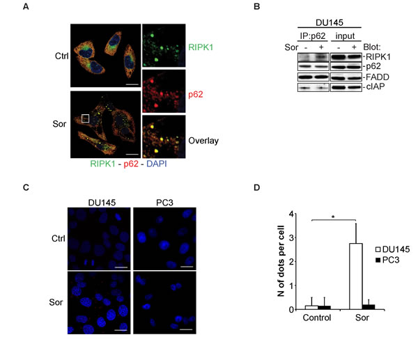 Sorafenib induces the interaction between p62 and RIPK1.