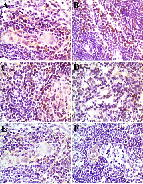 Changes of Bcl-2 protein expression in the thymus at 42 days of age