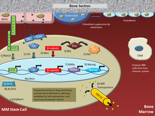 Putative multiple myeloma stem cell (MMSC) in the bone marrow microenvironment.