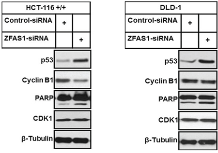 Western blot analysis of p53, Cyclin B1 and PARP cleavage after ZFAS1 siRNA transfection of HCT116+/+ and DLD-1 cells.