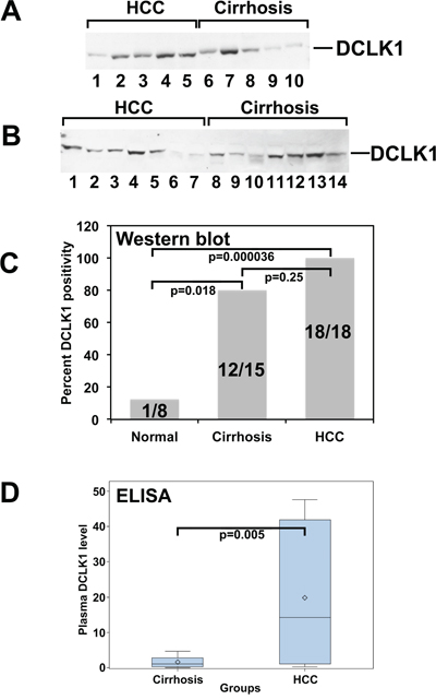 DCK1 protein levels are elevated in the plasma of patients with hepatocellular carcinoma. DCLK1 protein was detected and estimated using western blots and ELISA, respectively.