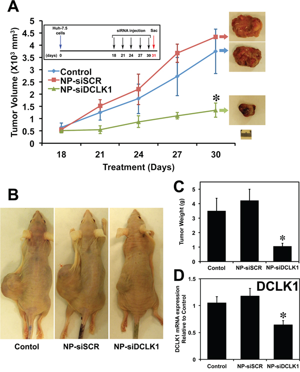 siRNA-mediated knockdown of DCLK1 results in human liver tumor xenograft growth arrest.