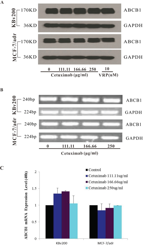 Effect of cetuximab on the expression of ABCB1 in MDR cells.