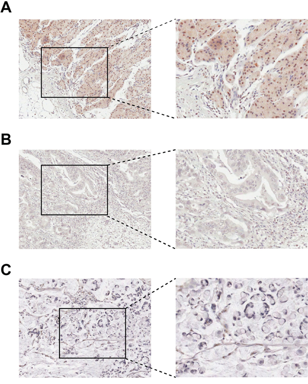 Immunohistochemical staining of HOXB9 in gastric tissues.