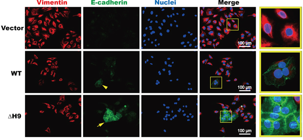 Immunocytochemistry analysis of cell morphogenesis during MET induction in gastric carcinoma cells.