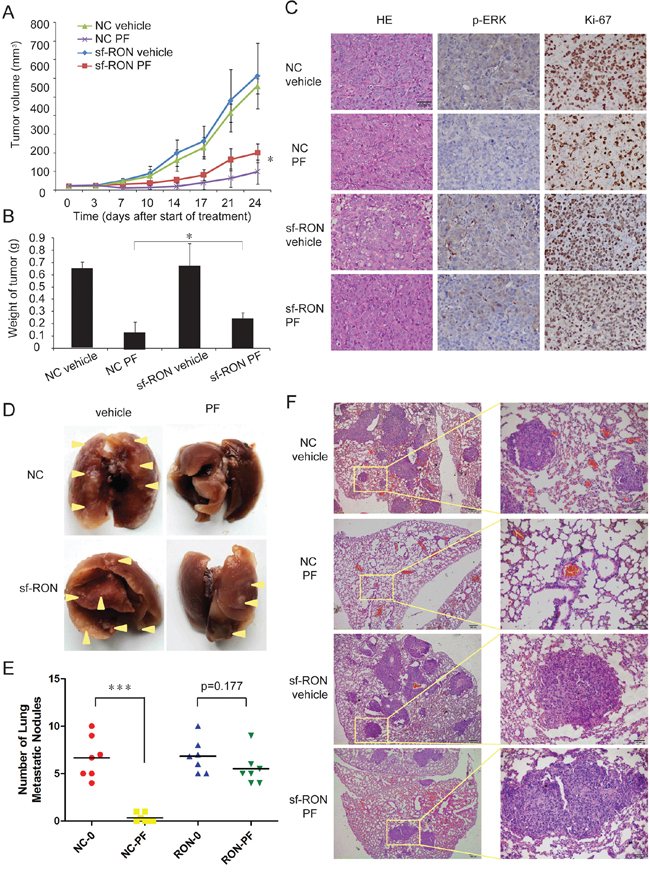 Upregulation of sf-RON contributed to PF resistance in vivo.