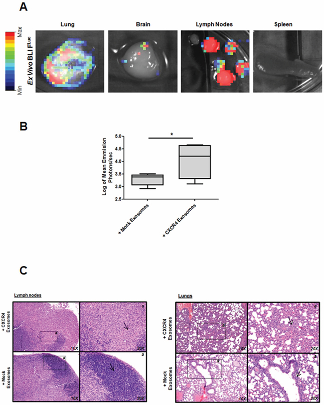 Metastasis after fat pad injection of MDA-MB-231FLuc cells in mice treated with exosomes.