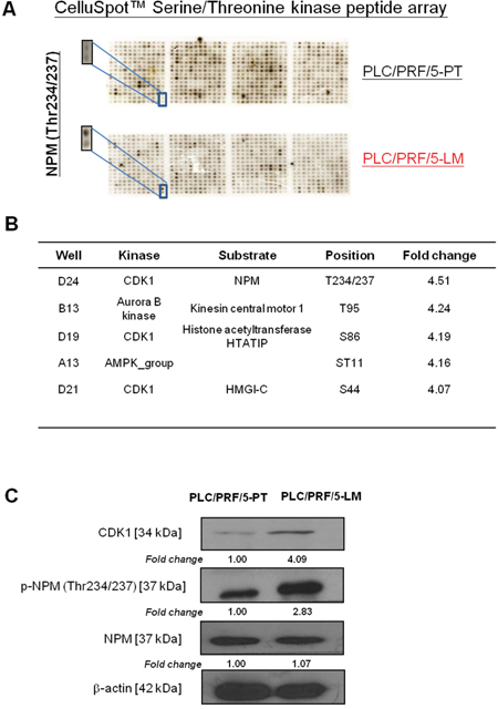 Identification of p-NPM-Thr234/237 by CelluSpot&#x2122; Serine/Threonine kinase peptide array analysis.