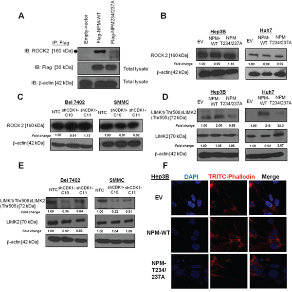 p-NPM-Thr234/237 regulated metastasis through Rho-ROCK-LIM kinase pathway.