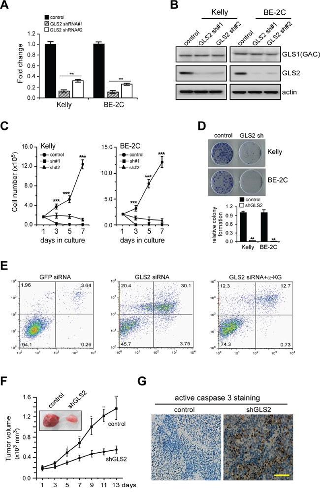 GLS2 sustains proliferation and viability of MYCN-Amplified neuroblastoma cells.