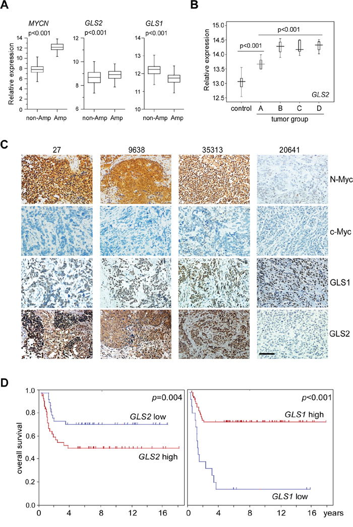Expression of GLS1 and GLS2 in primary neuroblastoma tumors.