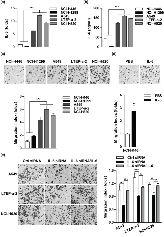 The level of IL-6 correlates to the abilities of cell migration in lung cancer cells.