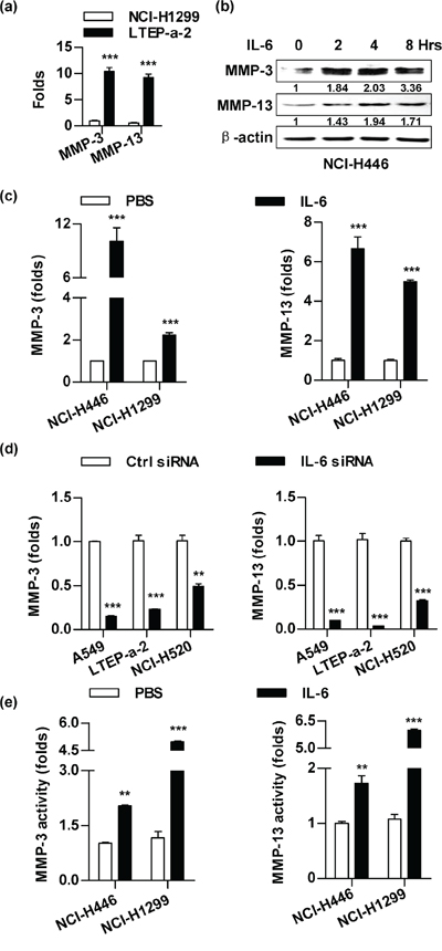 The treatment with IL-6 promotes the expressions and activities of MMP-3/MMP-13 in lung cancer cells.