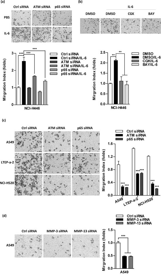 Inhibition of ATM and NF-&#x03BA;B activation abrogates the effect of IL-6 on cell migration in lung cancer cells.