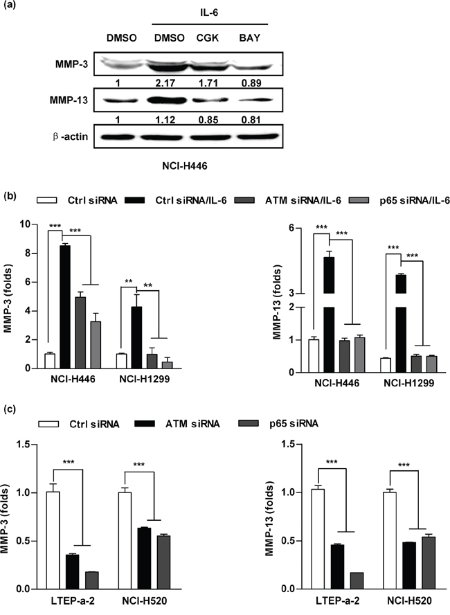 Inhibition of ATM and NF-&#x03BA;B activation abrogates the effect of IL-6 on MMP-3/MMP-13 up-regulation.