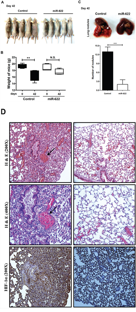 miR-622 inhibits the growth of xenografted lung cancer tumors.