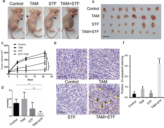 STF-080310 has a synergistic therapeutic effect with tamoxifen in a murine xenograft breast tumor model.